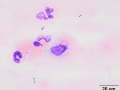 Histiocyte (erythrophagocytic)