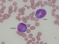 Progranulocyte & monocyte