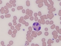 Eosinophil