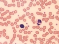 Neutrophil & lymphocyte