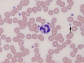 Neutrophil