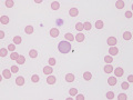Polychromatophil
