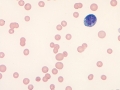 Mycoplasma haemofelis