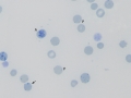 Reticulocytes