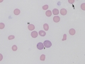 Polychromatophils & macrocytes
