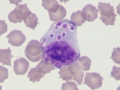 Granular lymphocyte