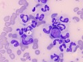 Histoplasma