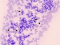 Histoplasma