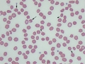 Oxidant injury