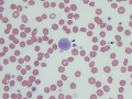 Oxidant injury