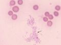 Mycoplasma hemofelis