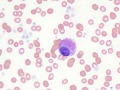 Mast cells