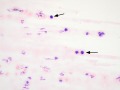 Mast cells
