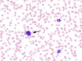 Mast cells