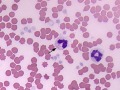 Mycobacteria