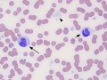Mycobacteria