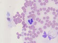 Mycobacteria
