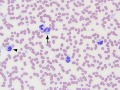 Mycobacteria
