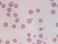 Macrocytes & polychromatophils