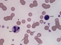 Inflammation & Mycoplasma