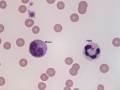 Inflammation