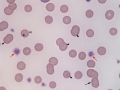 Mycoplasma & Heinz bodies