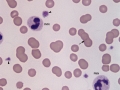 Inflammation & Mycoplasma