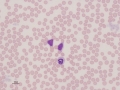 Band & lymphocyte