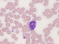 Basophil