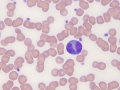 Monocyte
