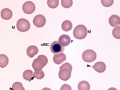 Mycoplasma, Heinz bodies & nRBC