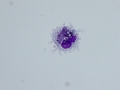 Sideroleukocyte