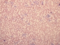 Platelet clumps