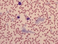 Platelet clumps
