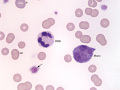 Mycoplasma & WBC