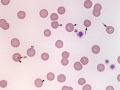 Mycoplasma & Heinz bodies