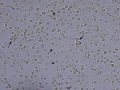 IMHA (wet prep)