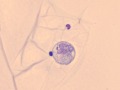 Feline infectious peritonitis