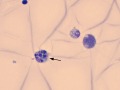 Feline infectious peritonitis