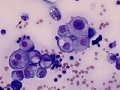 Suspect carcinoma