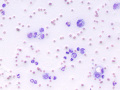 Feline infectious peritonitis
