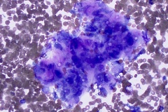 Female reproductive tract