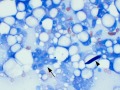 Mammary lipid-rich carcinoma (dog)