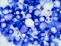Mammary lipid-rich carcinoma (dog, DQ)
