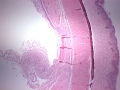 Spironucleus (H&E)