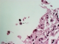 Spironucleus (H&E)