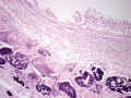 Spironucleus (H&E)