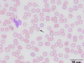 Babesia