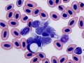 Phagocytic macrophages