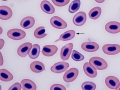 Dacryocyte